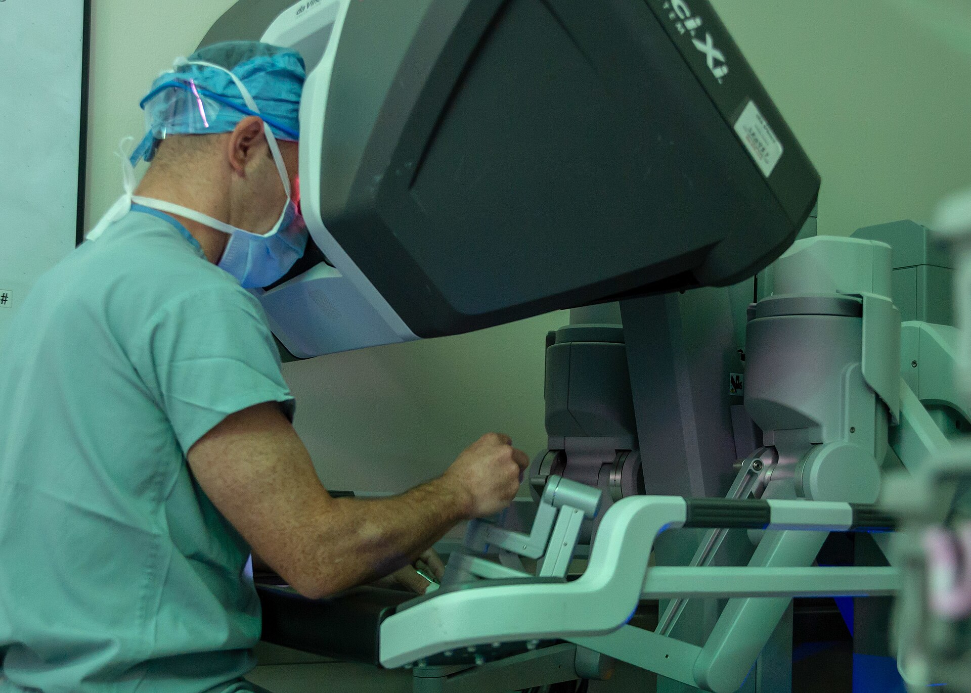 A surgeon in scrubs seated at the console of a da Vinci Xi surgical robot, hands on the controls